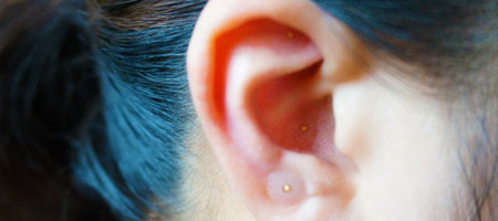 耳つぼダイエット